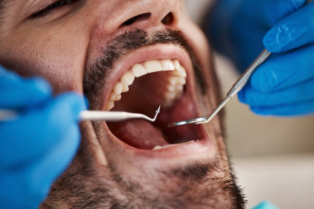 Best Walk-In Emergency Dentist in Colchester, IL